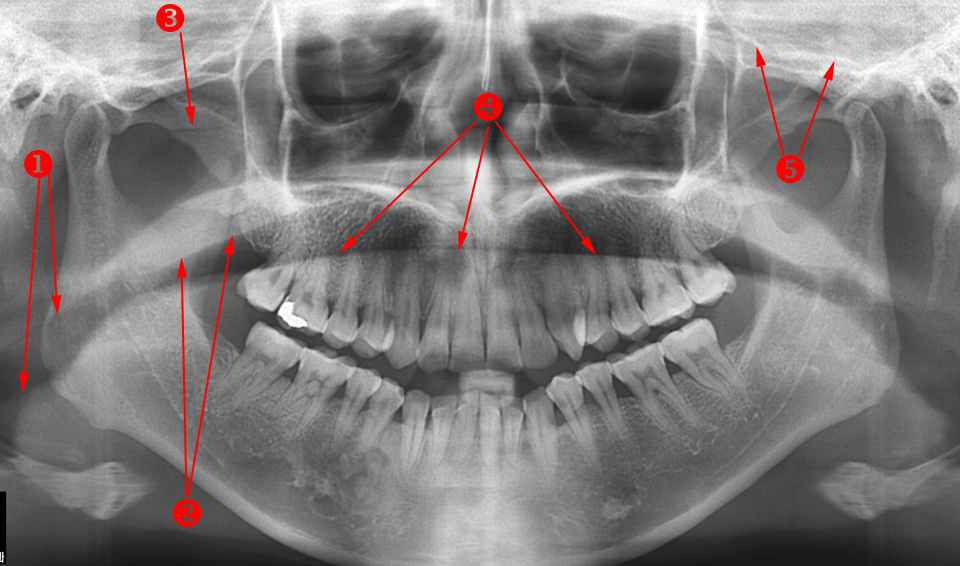 Oral Radiology U of MN